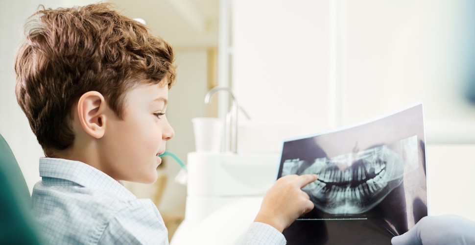 Tijdig een orthodontist vinden voor jongeren.jpeg